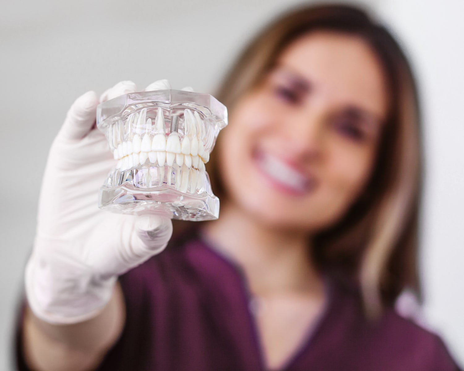 Dental Implants, Saint-Laurent Dentist