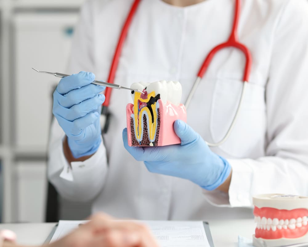 Root Canals, Saint-Laurent Dentist